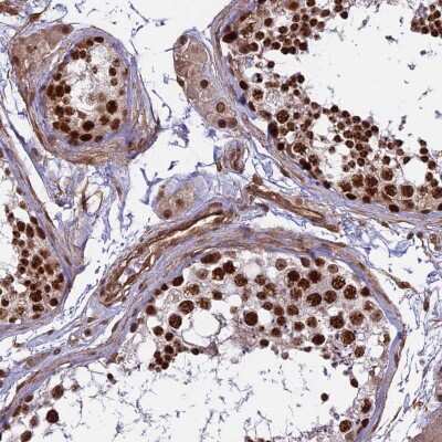 Immunohistochemistry-Paraffin: mpp8 Antibody [NBP1-92135] - Staining of human testis shows strong nuclear positivity in cells in seminiferous ducts and Leydig cells.