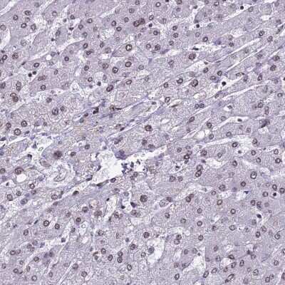 Immunohistochemistry-Paraffin: mpp8 Antibody [NBP1-92135] - Staining of human liver shows low expression as expected.