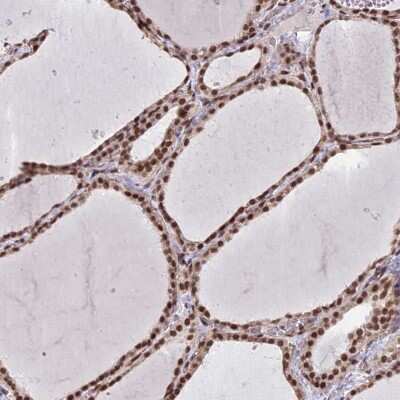 Immunohistochemistry-Paraffin: mpp8 Antibody [NBP1-92135] - Staining of human thyroid gland shows high expression.