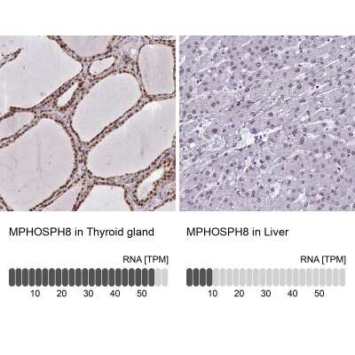 <b>Orthogonal Strategies Validation. </b>Immunohistochemistry-Paraffin: mpp8 Antibody [NBP1-92135] - Staining in human thyroid gland and liver tissues using anti-MPHOSPH8 antibody. Corresponding MPHOSPH8 RNA-seq data are presented for the same tissues.