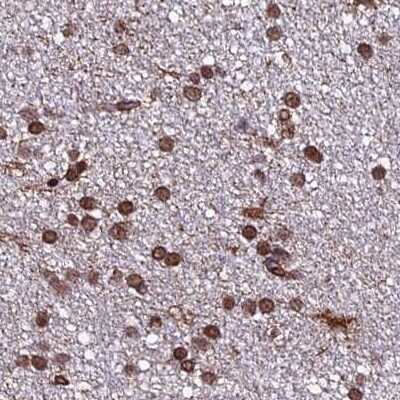 Immunohistochemistry-Paraffin: mpp8 Antibody [NBP1-92135] - Staining of human cerebral cortex.