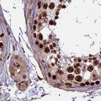 Immunohistochemistry-Paraffin: mpp8 Antibody [NBP1-92135] - Staining of human testis.