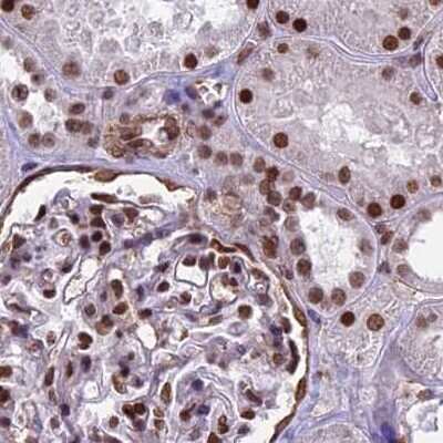 Immunohistochemistry-Paraffin: mpp8 Antibody [NBP1-92135] - Staining of human kidney.