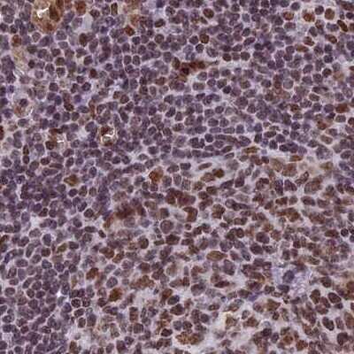 Immunohistochemistry-Paraffin: mpp8 Antibody [NBP1-92135] - Staining of human lymph node.