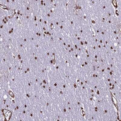 Immunohistochemistry-Paraffin: mpp8 Antibody [NBP1-92135] - Staining of human cerebral cortex shows strong nuclear positivity in glial cells.