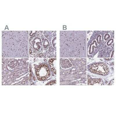 <b>Independent Antibodies Validation. </b>Immunohistochemistry-Paraffin: mpp8 Antibody [NBP1-92135] - Staining of human cerebral cortex, endometrium, kidney and testis using Anti-mpp8 antibody NBP1-92135 (A) shows similar protein distribution across tissues to independent antibody NBP1-92136 (B).