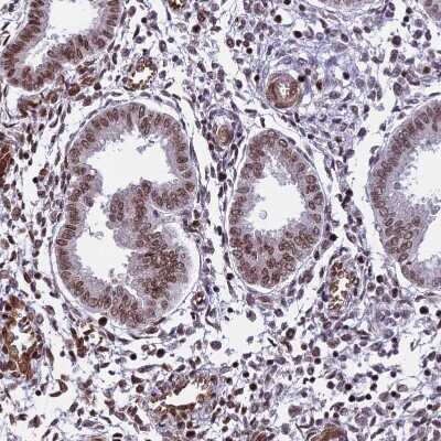 Immunohistochemistry-Paraffin: mpp8 Antibody [NBP1-92135] - Staining of human endometrium shows moderate nuclear positivity in glandular cells.