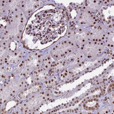 Immunohistochemistry-Paraffin: mpp8 Antibody [NBP1-92135] - Staining of human kidney shows moderate to strong nuclear positivity in cells in tubules.