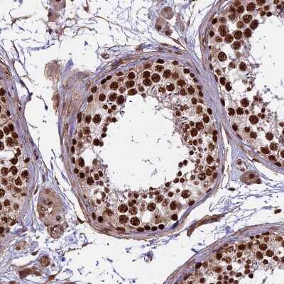 Immunohistochemistry-Paraffin: mpp8 Antibody [NBP1-92135] - Staining of human testis shows strong nuclear positivity in cells in seminiferous ducts.