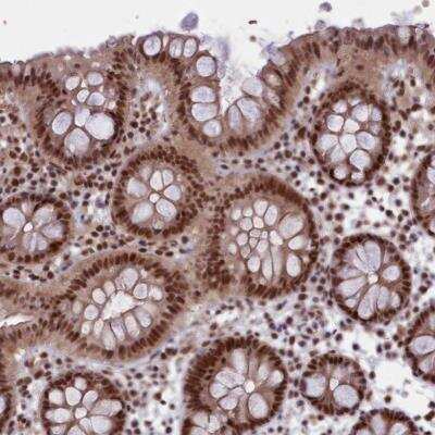 Immunohistochemistry-Paraffin: mpp8 Antibody [NBP1-92136] - Staining of human colon shows strong nuclear positivity in glandular cells.