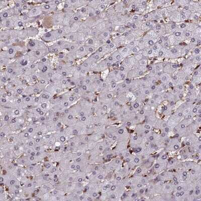 Immunohistochemistry-Paraffin: mpp8 Antibody [NBP1-92136] - Staining of human liver shows low expression as expected.