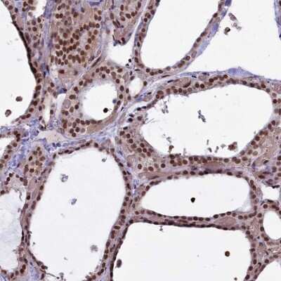 Immunohistochemistry-Paraffin: mpp8 Antibody [NBP1-92136] - Staining of human thyroid gland shows high expression.