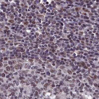 Immunohistochemistry-Paraffin: mpp8 Antibody [NBP1-92136] - Staining of human lymph node.