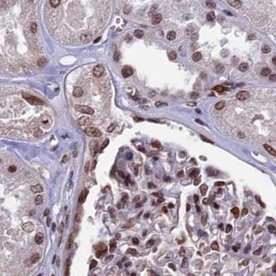 Immunohistochemistry-Paraffin: mpp8 Antibody [NBP1-92136] - Staining of human kidney.