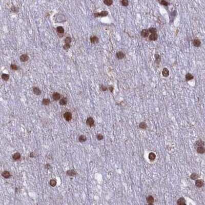 Immunohistochemistry-Paraffin: mpp8 Antibody [NBP1-92136] - Staining of human cerebral cortex.