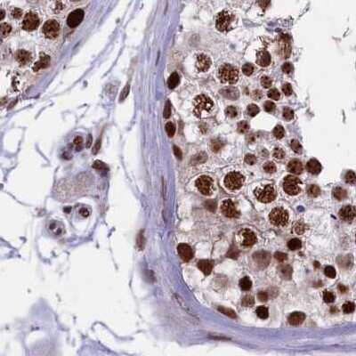 Immunohistochemistry-Paraffin: mpp8 Antibody [NBP1-92136] - Staining of human testis.