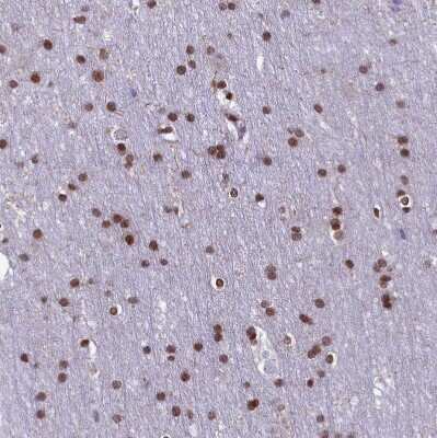 Immunohistochemistry-Paraffin: mpp8 Antibody [NBP1-92136] - Staining of human cerebral cortex shows strong nuclear positivity in glial cells.