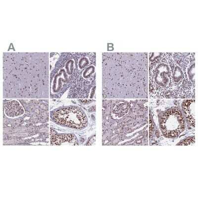 Immunohistochemistry-Paraffin: mpp8 Antibody [NBP1-92136] - Staining of human cerebral cortex, endometrium, kidney and testis using Anti-mpp8 antibody NBP1-92136 (A) shows similar protein distribution across tissues to independent antibody NBP1-92135 (B).