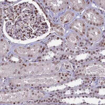 Immunohistochemistry-Paraffin: mpp8 Antibody [NBP1-92136] - Staining of human kidney shows moderate to strong nuclear positivity in cells in tubules.