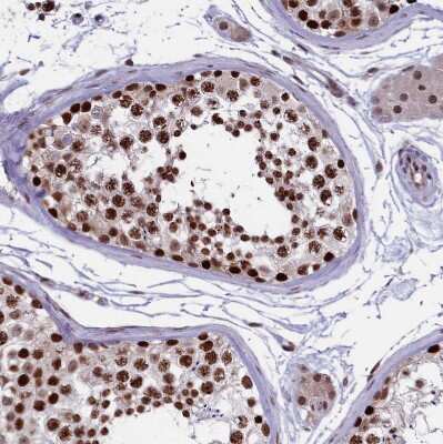 Immunohistochemistry-Paraffin: mpp8 Antibody [NBP1-92136] - Staining of human testis shows strong nuclear positivity in cells in seminiferous ducts.