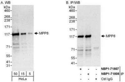 Western Blot: mpp8 Antibody [NBP1-71808] - Whole cell lysate (5, 15 and 50 mcg for WB; 1 mg for IP, 20% of IP loaded) from HeLa cells.  Antibodies: Affinity purified rabbit anti-MPP8 antibody used for WB at 0.1 mcg/ml (A) and 1 mcg/ml (B) and used for IP at 6 mcg/mg lysate.  MPP8 was also immunoprecipitated by rabbit anti-MPP8 antibody NBP1-71807, which recognizes a downstream epitope.