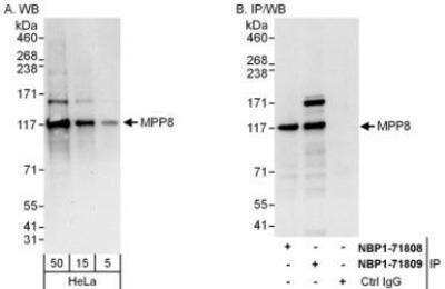 Western Blot: mpp8 Antibody [NBP1-71809] - Whole cell lysate (5, 15 and 50 mcg for WB; 1 mg for IP, 20% of IP loaded) from HeLa cells.   Affinity purified rabbit anti-MPP8 antibody used for WB at 0.1 mcg/ml (A) and 1 mcg/ml (B) and used for IP at 6 mcg/mg lysate.  MPP8 was also immunoprecipitated by rabbit anti-MPP8 antibody NBP1-71808, which recognizes an upstream epitope.