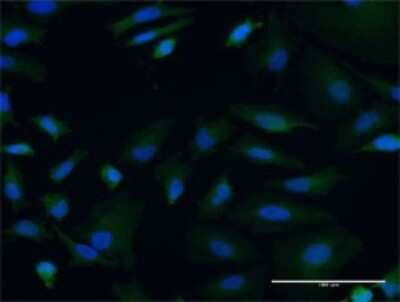 Immunocytochemistry/Immunofluorescence: mtRNA polymerase Antibody (3D9) [H00005442-M01] - Analysis of monoclonal antibody to POLRMT on HeLa cell . Antibody concentration 10 ug/ml.