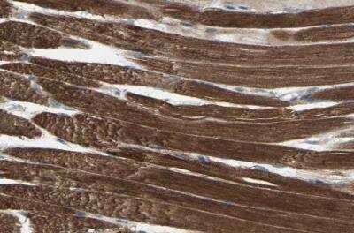 Immunohistochemistry-Paraffin: mtRNA polymerase Antibody [NBP1-90126] - Staining of human skeletal muscle shows strong granular cytoplasmic positivity in myocytes.