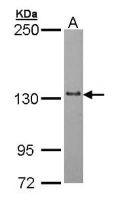 Western Blot: mtRNA polymerase Antibody [NBP2-19436] - Sample (30 ug of whole cell lysate) A: Hep G2 5% SDS PAGE gel, diluted at 1:1000.