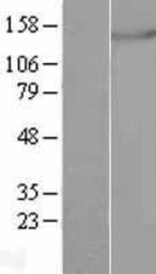 Western Blot: mtRNA polymerase Overexpression Lysate (Adult Normal) [NBL1-14597] Left-Empty vector transfected control cell lysate (HEK293 cell lysate); Right -Over-expression Lysate for mtRNA polymerase.