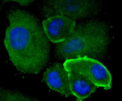Immunocytochemistry/Immunofluorescence: mtTFA Antibody (JM32-44) [NBP2-75577] - Staining mtTFA in SK-Br-3 cells (green). The nuclear counter stain is DAPI (blue). Cells were fixed in paraformaldehyde, permeabilised with 0.25% Triton X100/PBS.
