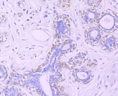 Immunohistochemistry-Paraffin: mtTFA Antibody (JM32-44) [NBP2-75577] - Analysis of paraffin-embedded human breast tissue using anti-mtTFA antibody. Counter stained with hematoxylin.