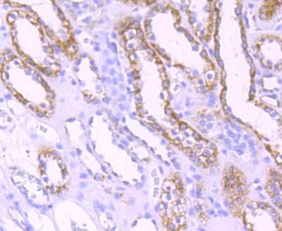 Immunohistochemistry-Paraffin: mtTFA Antibody (JM32-44) [NBP2-75577] - Analysis of paraffin-embedded human kidney tissue using anti-mtTFA antibody. Counter stained with hematoxylin.