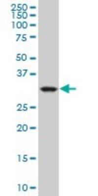 Western Blot: mu Crystallin Antibody (1C6) [H00001428-M09] - Analysis of CRYM expression in K-562 (Cat # L009V1).