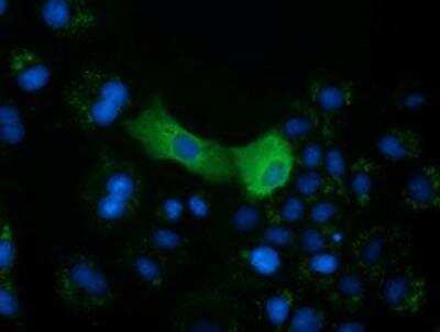 Immunocytochemistry/Immunofluorescence: mu Crystallin Antibody (OTI1G7) [NBP2-02829] - Staining of COS7 cells transiently transfected by pCMV6-ENTRY mu Crystallin.