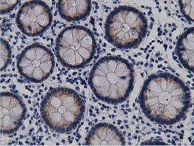 Immunohistochemistry-Paraffin: mu Crystallin Antibody (1G7) [NBP2-02829] - Staining of paraffin-embedded Human colon tissue using anti-mu Crystallin mouse monoclonal antibody.