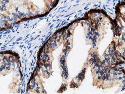 Immunohistochemistry-Paraffin: mu Crystallin Antibody (1G7) [NBP2-02829] - Staining of paraffin-embedded Human prostate tissue using anti-mu Crystallin mouse monoclonal antibody.