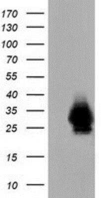 Western Blot: mu Crystallin Antibody (1G7) [NBP2-02829] - HEK293T cells were transfected with the pCMV6-ENTRY control (Left lane) or pCMV6-ENTRY mu Crystallin (Right lane) cDNA for 48 hrs and lysed. Equivalent amounts of cell lysates (5 ug per lane) were separated by SDS-PAGE and immunoblotted with anti-mu Crystallin.