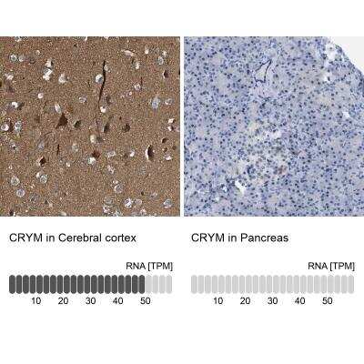 <b>Orthogonal Strategies Validation. </b>Immunohistochemistry-Paraffin: mu Crystallin Antibody [NBP1-85241] - Staining in human cerebral cortex and pancreas tissues using anti-CRYM antibody. Corresponding CRYM RNA-seq data are presented for the same tissues.