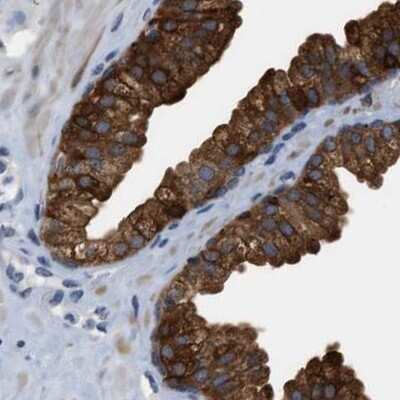 Immunohistochemistry-Paraffin: mu Crystallin Antibody [NBP1-85241] - Staining of human prostate.
