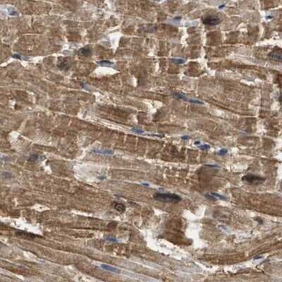 Immunohistochemistry-Paraffin: mu Crystallin Antibody [NBP1-85241] - Staining of human heart muscle.