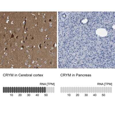 <b>Orthogonal Strategies Validation. </b>Immunohistochemistry-Paraffin: mu Crystallin Antibody [NBP1-85241] - Analysis in human cerebral cortex and pancreas tissues. Corresponding mu Crystallin RNA-seq data are presented for the same tissues.