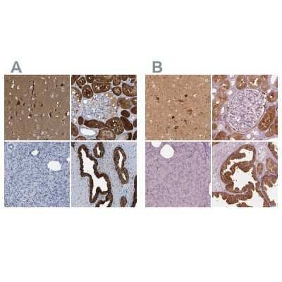 <b>Independent Antibodies Validation. </b>Immunohistochemistry-Paraffin: mu Crystallin Antibody [NBP1-85241] - Staining of human cerebral cortex, kidney, pancreas and prostate using Anti-mu Crystallin antibody NBP1-85241 (A) shows similar protein distribution across tissues to independent antibody NBP2-55172 (B).