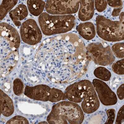 Immunohistochemistry-Paraffin: mu Crystallin Antibody [NBP1-85241] - Staining of human kidney shows strong cytoplasmic positivity in cells in tubules.