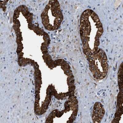 Immunohistochemistry-Paraffin: mu Crystallin Antibody [NBP1-85241] - Staining of human prostate shows strong cytoplasmic positivity in glandular cells.
