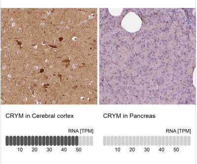 Immunohistochemistry-Paraffin: mu Crystallin Antibody [NBP2-55172] - Analysis in human cererbral cortex and pancreas tissues.  Corresponding CRYM RNA-seq data are presented for the same tissues.