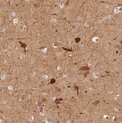 Immunohistochemistry-Paraffin: mu Crystallin Antibody [NBP2-55172] - Staining of human cerebral cortex shows moderate to strong cytoplasmic positivity in neurons.