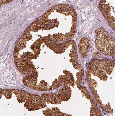 Immunohistochemistry-Paraffin: mu Crystallin Antibody [NBP2-55172] - Staining of human prostate shows moderate to strong cytoplasmic positivity in glandular cells.