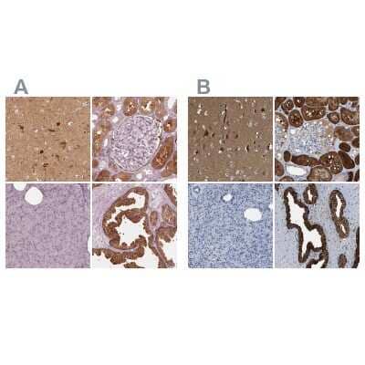 Immunohistochemistry-Paraffin: mu Crystallin Antibody [NBP2-55172] - Staining of human cerebral cortex, kidney, pancreas and prostate using Anti-mu Crystallin antibody NBP2-55172 (A) shows similar protein distribution across tissues to independent antibody NBP1-85241 (B).