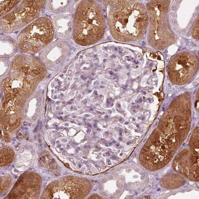 Immunohistochemistry-Paraffin: mu Crystallin Antibody [NBP2-55172] - Staining of human kidney shows moderate to strong cytoplasmic positivity in cells in tubules.